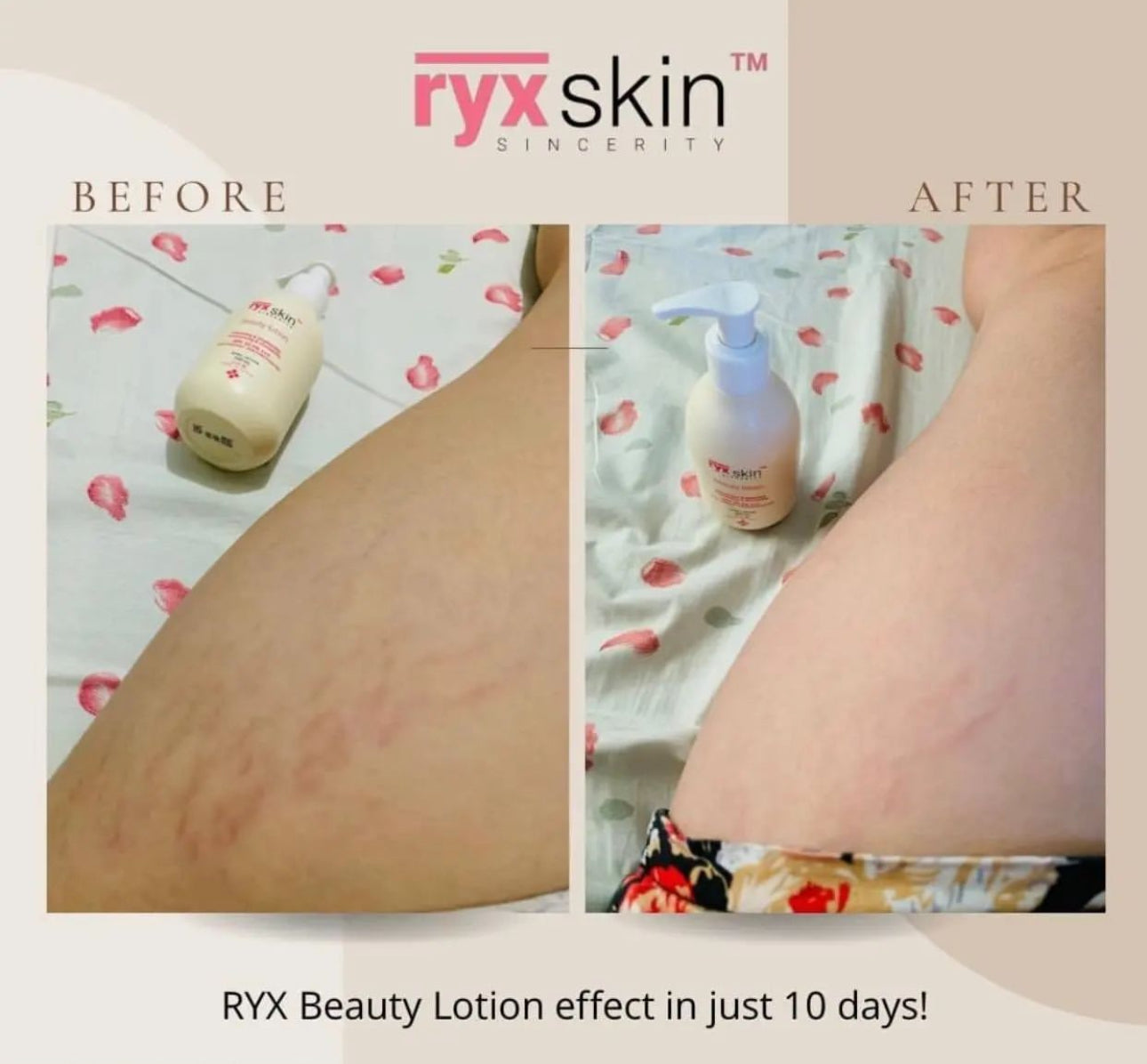 RYX Skin  Whitening Beauty Lotion SPF50 200ml
