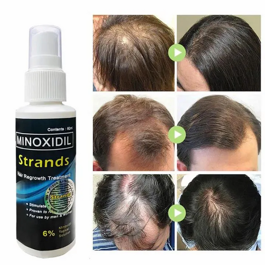 Strands Minoxidil 6% Ultimate for Hairgrow 60ml